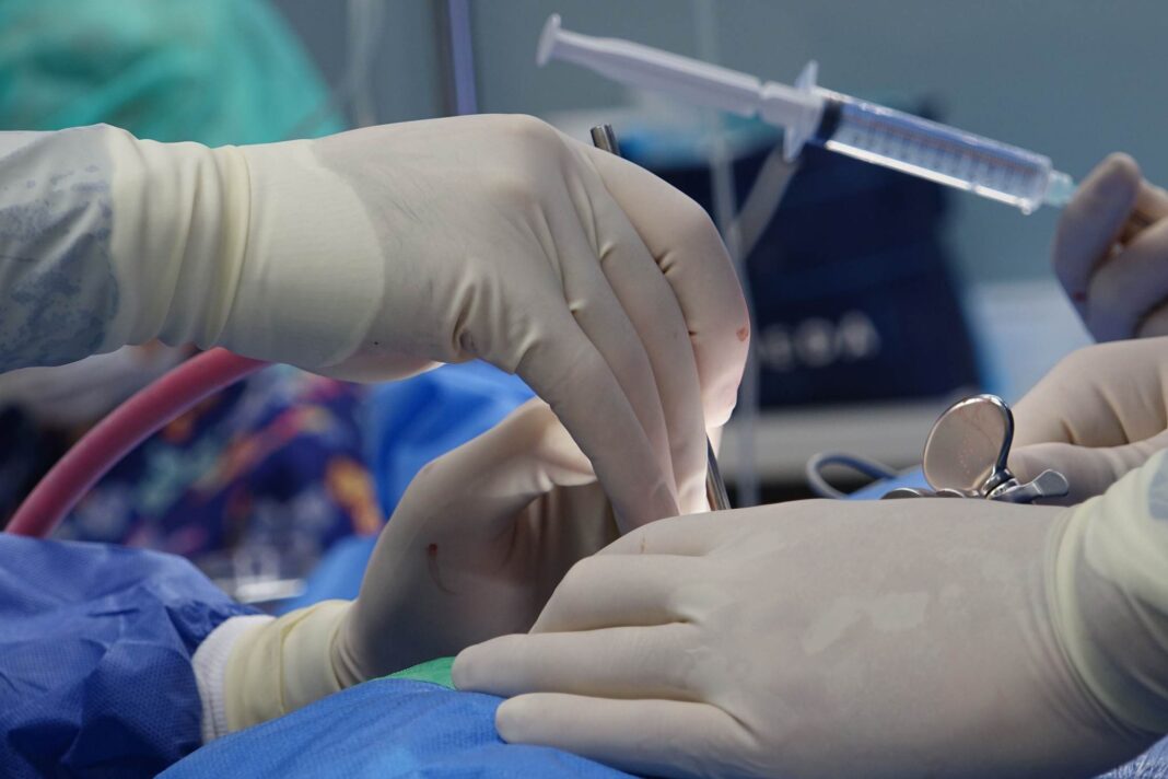 mastectomia endoscopica